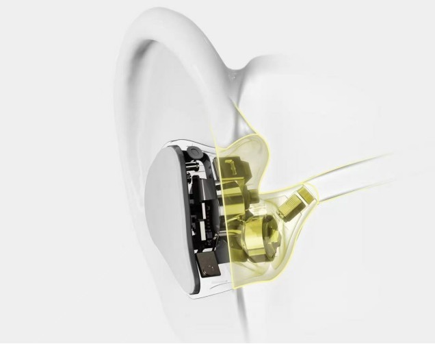 定制無(wú)線(xiàn)耳機(jī)發(fā)明者——聽(tīng)智慧，以技術(shù)創(chuàng)新+118項(xiàng)專(zhuān)利壁壘，引領(lǐng)行業(yè)新范式